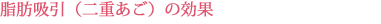 脂肪吸引(二重あご)の効果